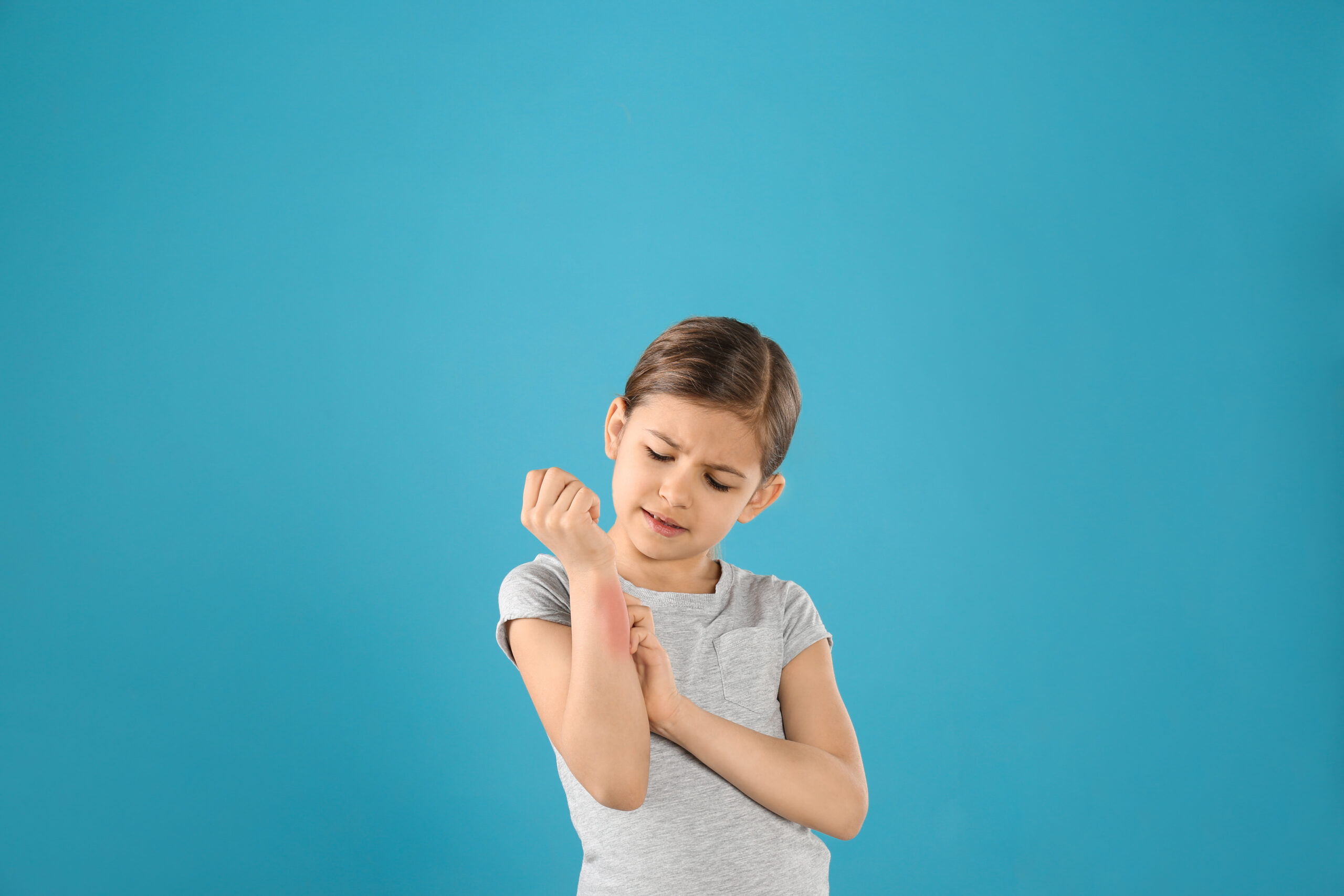 Little girl scratching forearm on color background. Allergy symptoms