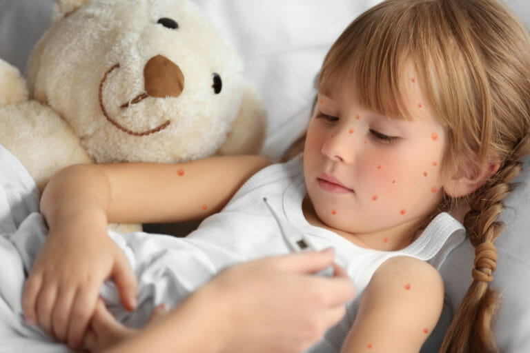 Chickenpox Vaccine For Children Childhealthy London